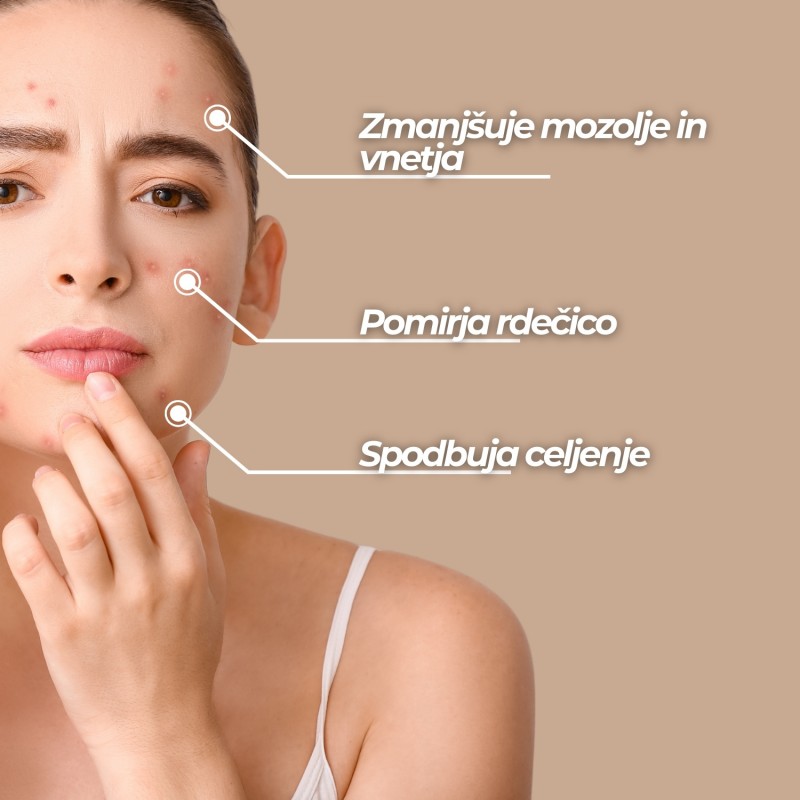 Krema za obraz proti aknam - 50ml