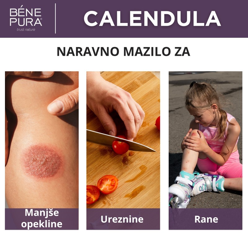 Mazilo za Opekline in Rane z Ognjičem - 40ml