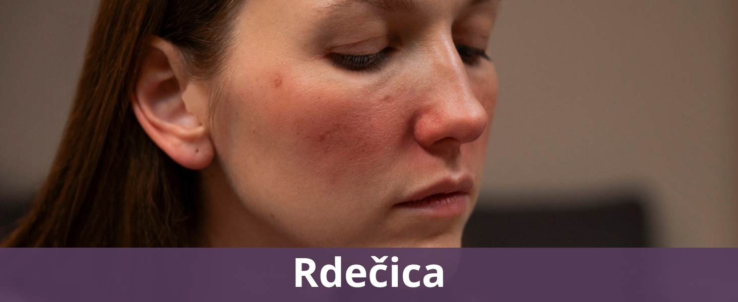 Rdečica