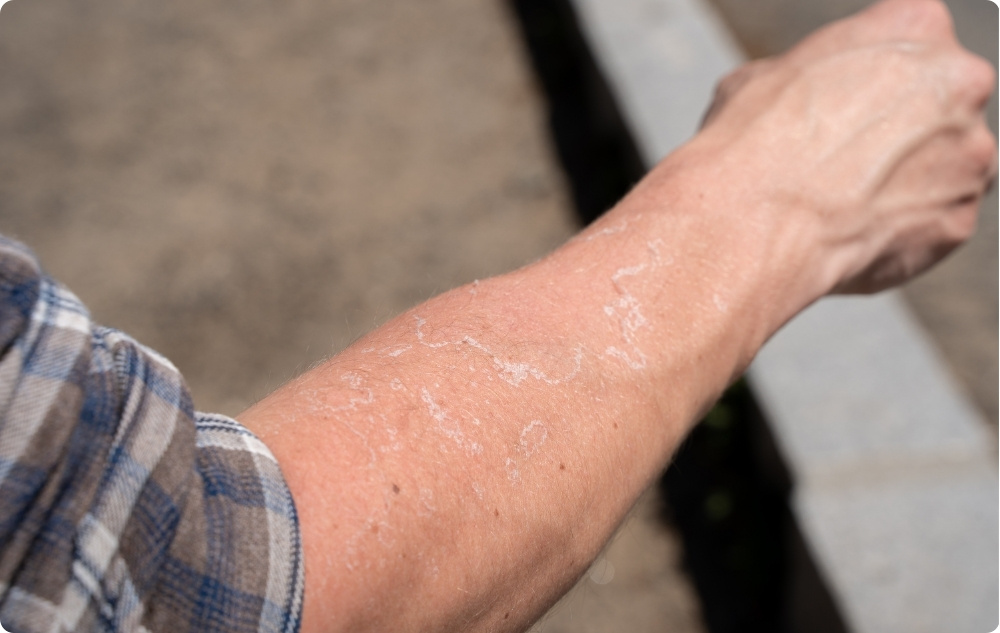 Kot olje za razdraženo in suho kožo